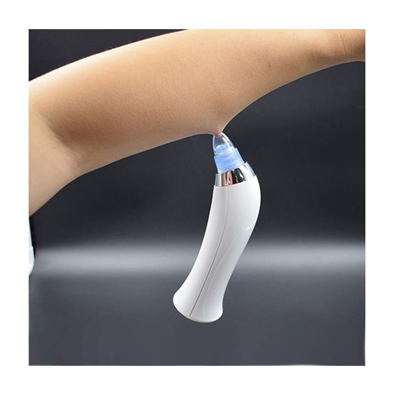 high suction black head remover