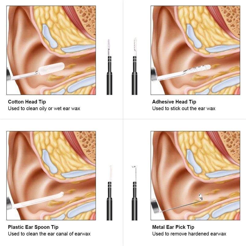 easy to use ear wax removal