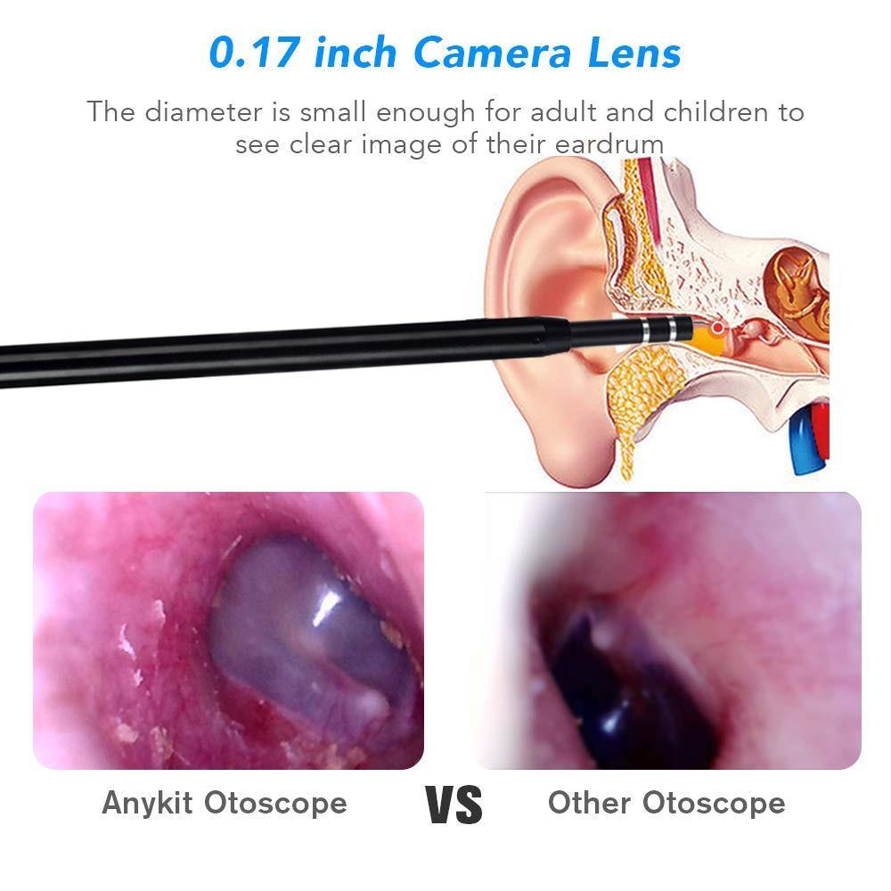 0.17 inch camera visual ear wax removal
